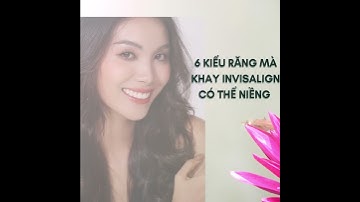 Các loại răng có thể điều trị bằng Invisalign |Tt niềng răng quốc tế Diamond