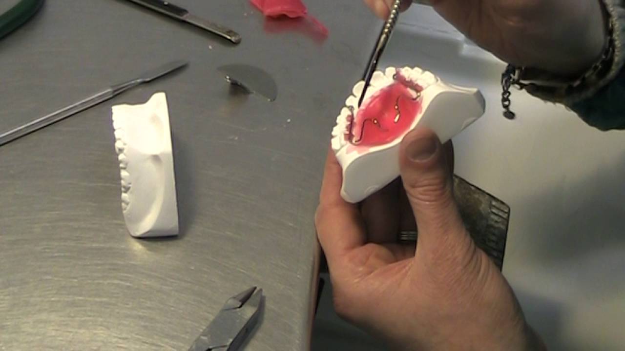 Apparecchio funzionale parte 2 su 11