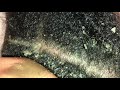 Dandruff Scratching: Big Flakes, No Talking Part 5 #Top