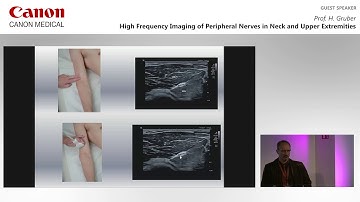 Professor H. Gruber - High Frequency Imaging of Peripheral Nerves in Neck and Upper Extremities