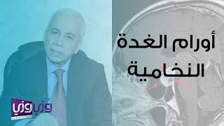 أورام الغدة النخامية