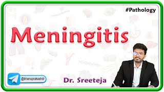 4. Meningitis | USMLE Step 1 Pathology