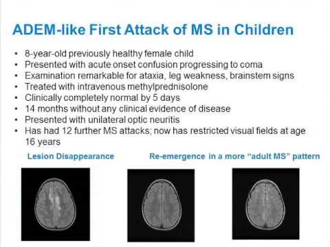Video: Pædagogens Vejledning Til Pædiatrisk Multipel Sklerose (MS)
