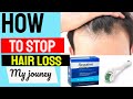HOW TO STOP HAIR LOSS - MY JOURNEY &amp; PRODUCTS