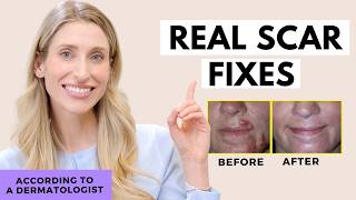 Fade Scars FAST (and for real) | Dr. Sam Ellis Dermatologist S Healthy Haircare Upgrades For 2025 Dr Sam Ellis