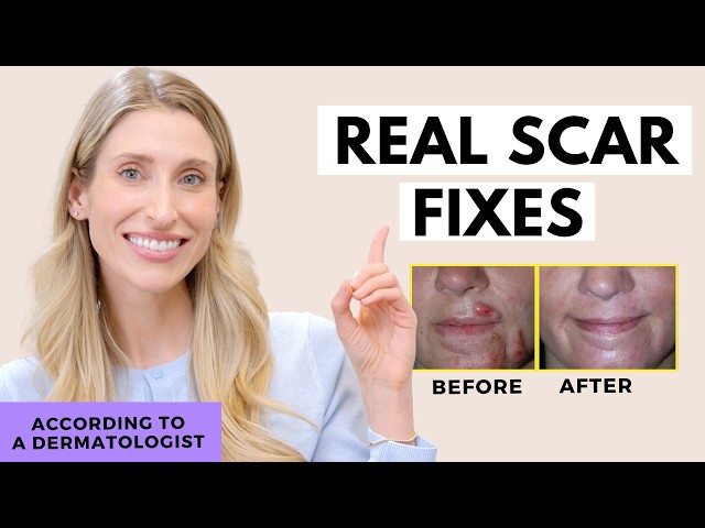 glutathione before and after Fade Scars FAST (and for real) | Dr. Sam Ellis