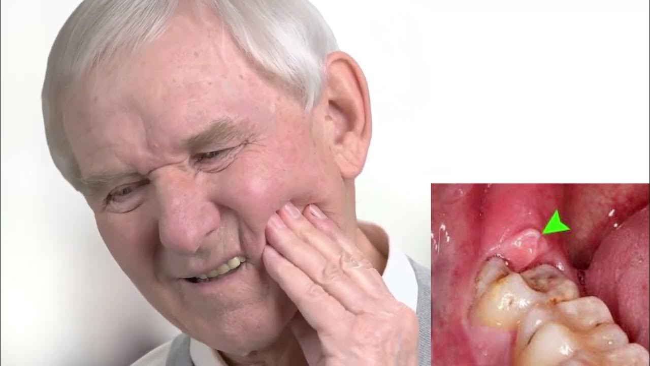 what causes tooth pain and remedies for tooth pain relief YouTube
