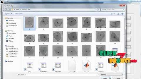 Final Year Projects 2015 | Semi-Automatic Segmentation and Classification