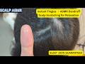 Instant Tingles ✨ ASMR Dandruff Scalp Scratching for Relaxation #42 @OceansASMR