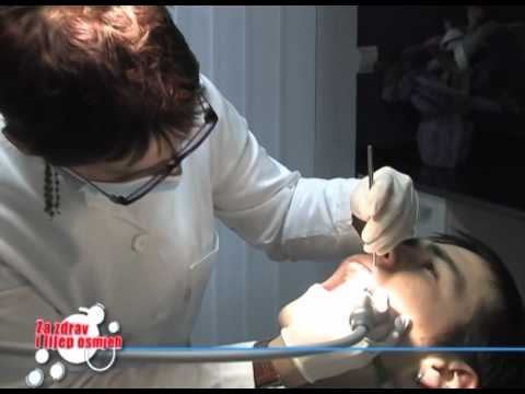 Video: Gingivitis I Parodontna Bolest U Ferata