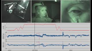 EEG based prediction of intensity of Microsleep using deeplearning