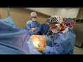 Radical Breast Reduction H-cup to a A-cup | /Dr. Tony Mangubat Seattle | Non-Binary Surgery