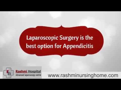 Laparoscopic Appendicitis Surgery | Appendix Treatment In Bangalore ...
