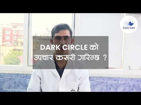 Dark Circle को उपचार कसरी गरिन्छ ?|Dr. Dhiraj KC
