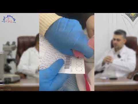 فحص الغربلة للاطفال حديثي الولادة رسالة توعية