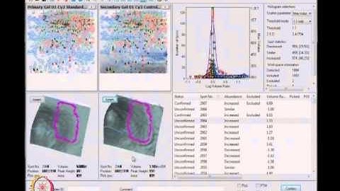 Mod-17 Lec-17 Difference gel electrophoresis (continued) Discussion and data analysis