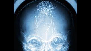 机器大脑诞生：科学家首次利用大脑植入装置提高人类记忆
