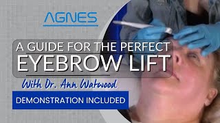 Agnes Nonsurgical Brow Lift: Step-by-Step Demonstration to Correct Brow and Lid Ptosis