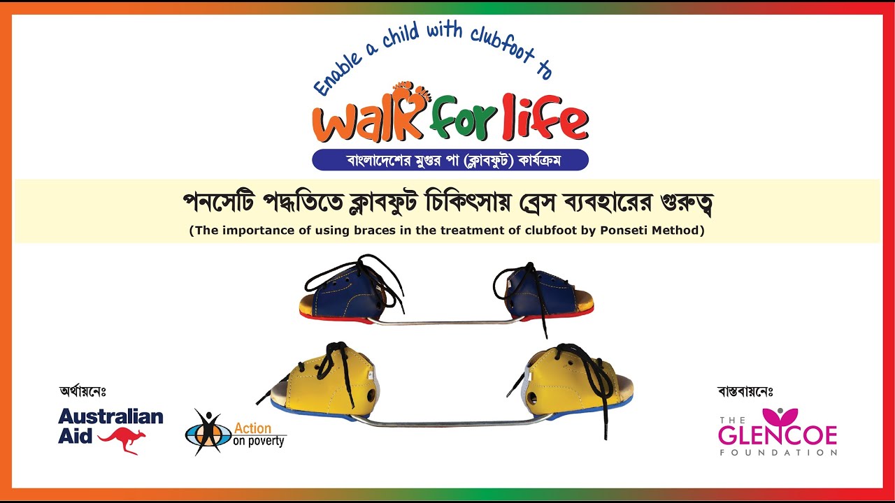 Importance of Bracing in Clubfoot Treatment (Walk For Life)