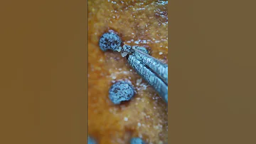 БУЛОЧКА С МАКОМ ПОД МИКРОСКОПОМ