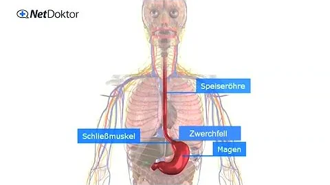 Kann Reflux wieder weggehen?