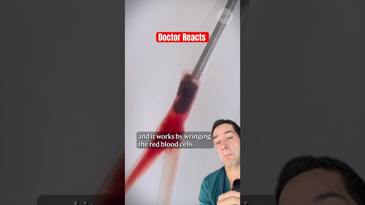 The surprising way doctors remove a blood clot