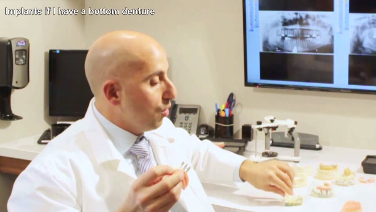 Implants if I have a bottom denture? | Daniel Daniel Dentistry