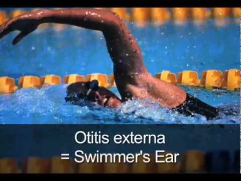 Otitis Externa 1- swimmer's ear, definition, causes, external ear canal ...