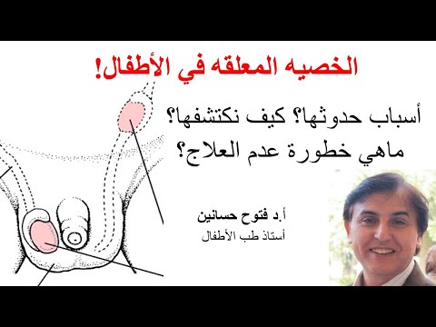 فيديو: ما هي المواضيع العالقة في Weblogic؟