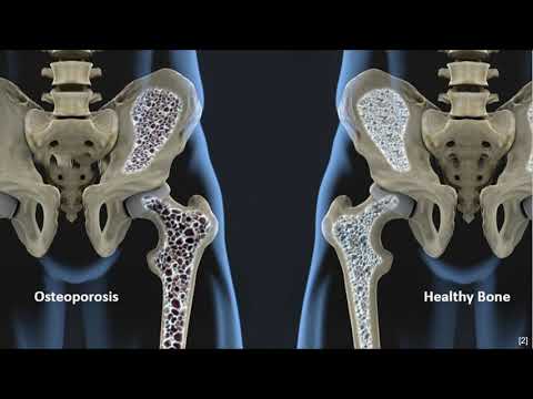 Video: Mechanische Kontrolle Von Tissue Engineered Bone