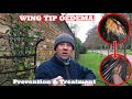 WING TIP OEDEMA / Harris’ Hawks, HOW TO Prevent & Treat Wing Tip Oedema