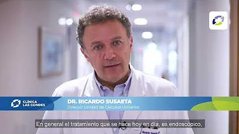 ¿Cómo saber si un cálculo renal está a punto de desaparecer?