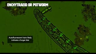Autofluorescent Potworm Hairs Seen w/Epifluorescence Microscopy | Regenerative Soil Microscopy