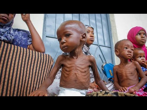 7 ملايين صومالي على شفا المجاعة بسبب الجفاف الشديد
 - 21:54-2022 / 8 / 14