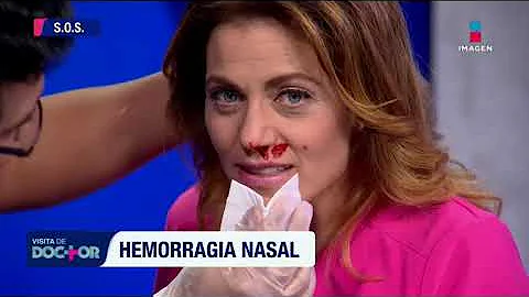 ¿Cuánto tiempo debe durar una hemorragia nasal?