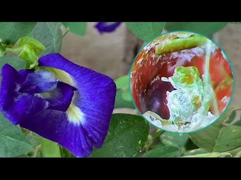 耳掃除の難聴最大の耳垢除去  | イヤークリーニング | fsfsf |耳垢の除去 Ep29