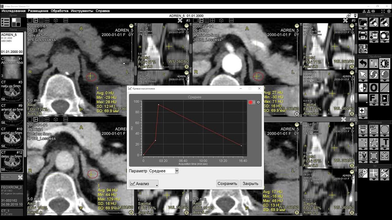 Vidar dicom viewer 3. Vidar dicom. vidar dicom viewer. видар программа для кт.