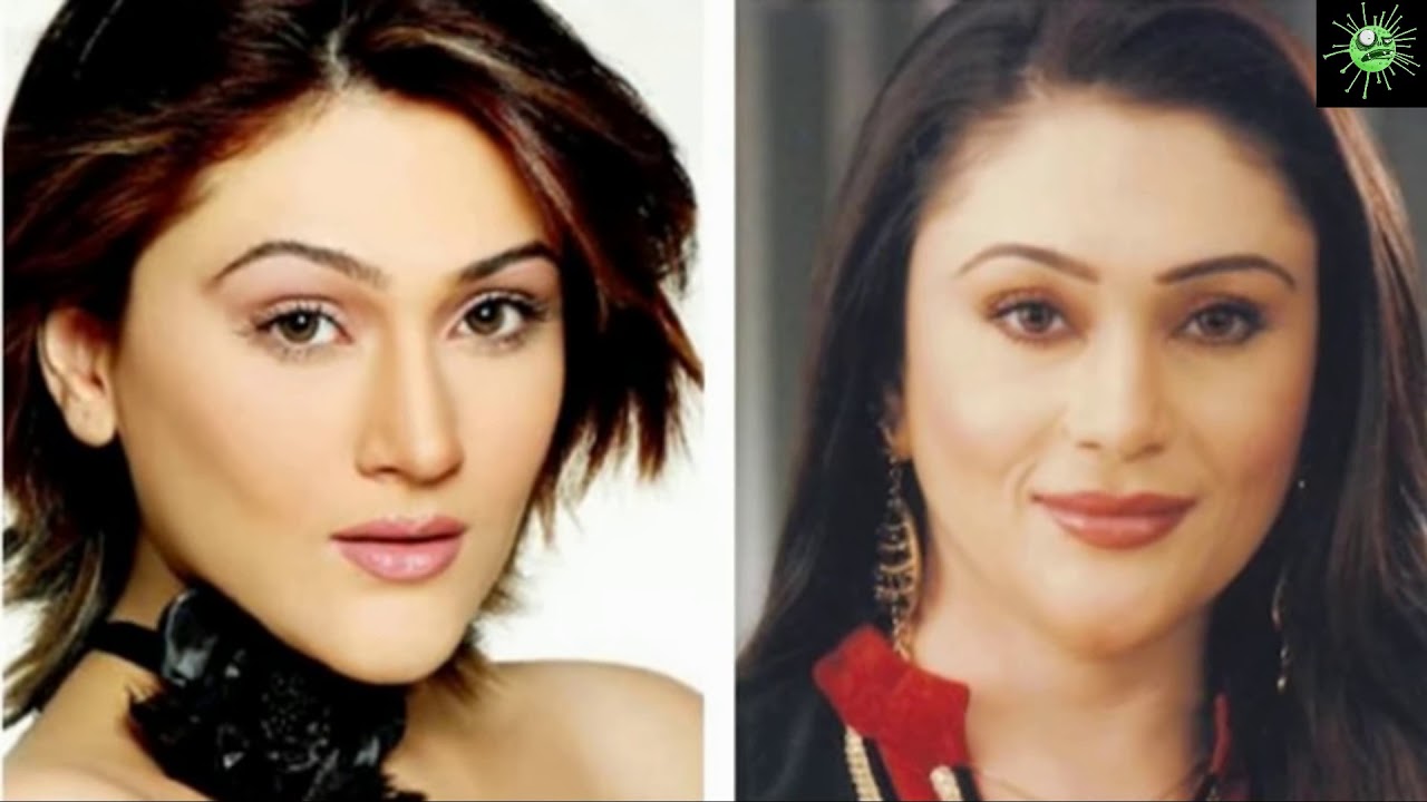 bollywood news, bollywood, plastic surgery, plastic surgery before and afte...