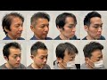 【はげ薄毛】薄毛が目立たない理想のヘアスタイルに大変身!