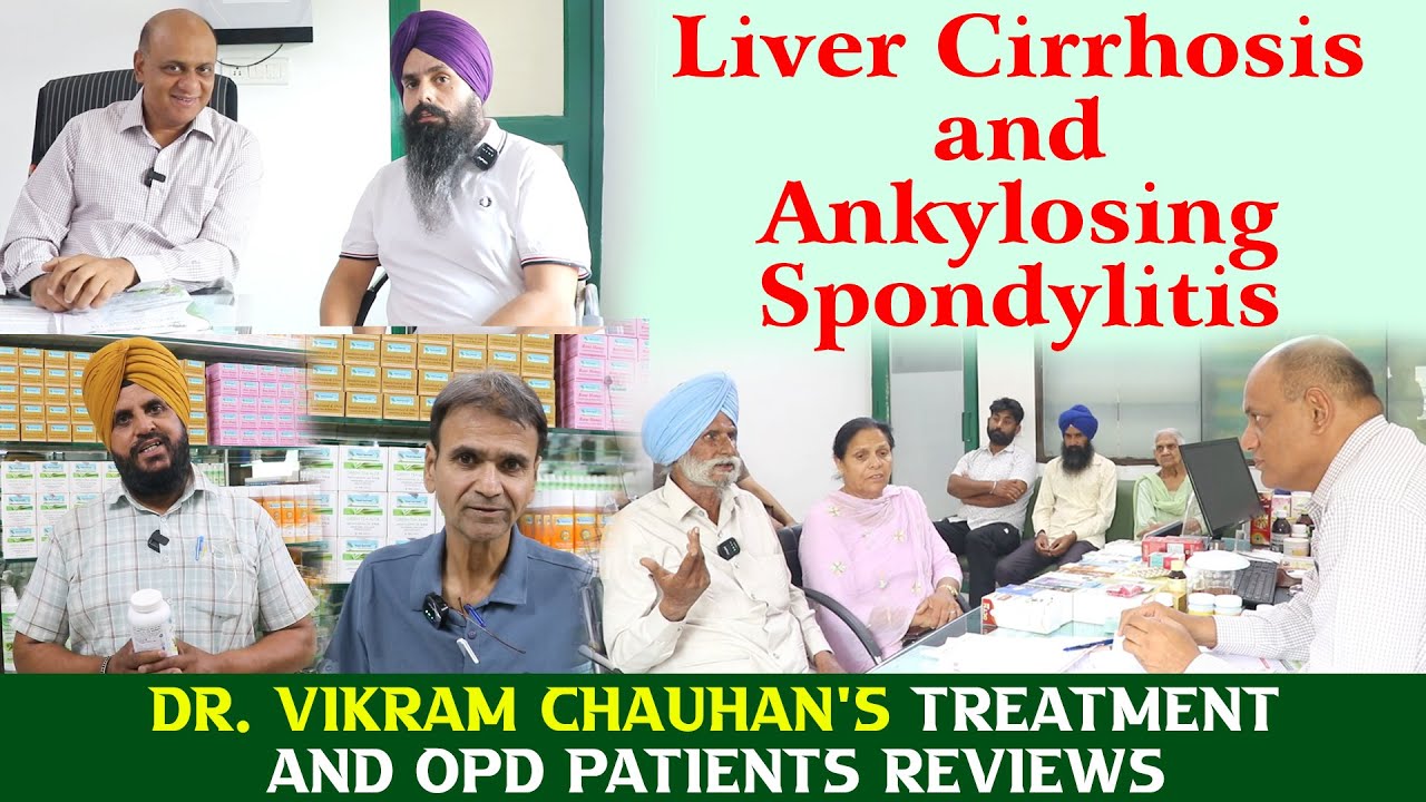 Watch Video Liver Cirrhosis and Ankylosing Spondylitis - Dr. Vikram Chauhan Treatment and OPD Patients Reviews