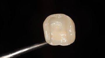 Emax cementation full protocol