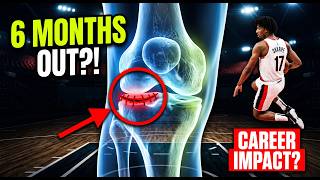 Shaedon Sharpe Meniscus Tear: What His 6-Month Timeline ACTUALLY Means (Doctor Breakdown)