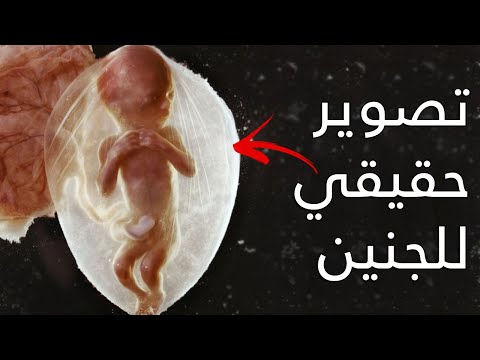 تصوير حقيقي لجنين بشري ينمو داخل الرحم بتقنية رباعية الابعاد