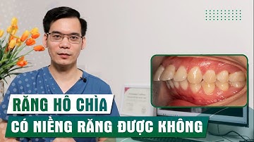 Răng Hô Chìa Có Niềng Răng Được Không?