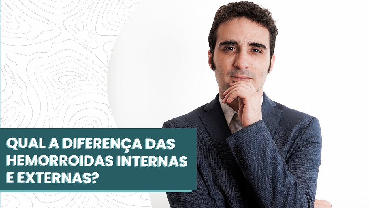 Hemorroidas Internas Vs Externas Externe Hämorrhoiden Rektumstruktur