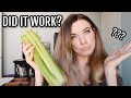 I TRIED CELERY JUICE TO CURE MY CHRONIC ILLNESS & THIS IS WHAT HAPPENED | 2 Year Acid Reflux Update