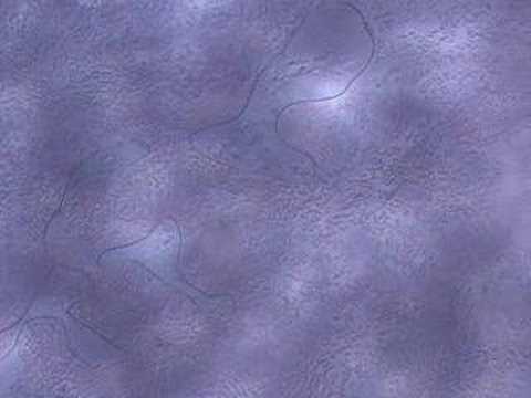 Blood sample Blood sample