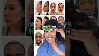 Botox can help with jaw pain, particularly in cases of temporomandibular joint (TMJ) disorders and