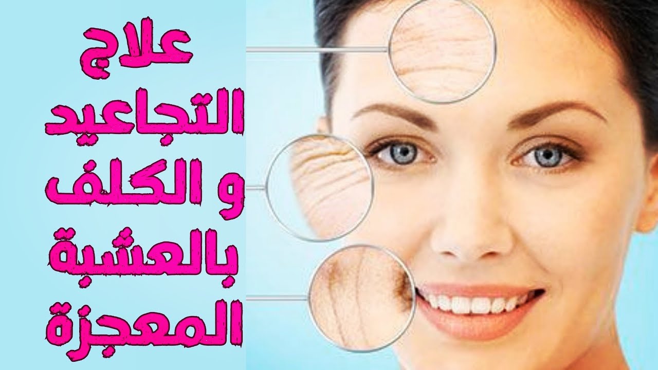 علاج التجاعيد الوجه و الكلف و النمش ب عشبة الكثيرة . الكثيراء | وصفات علاج التجاعيد