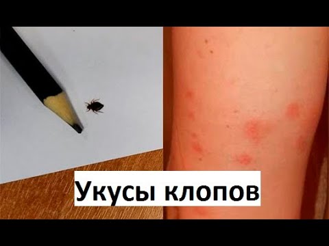 Вопрос: Что это за насекомое Клоп?